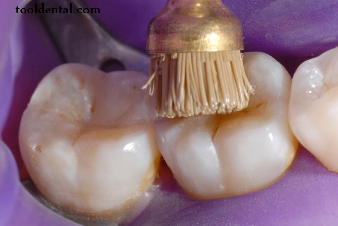 نمایندگی مواد مصرفی دندانپزشکی