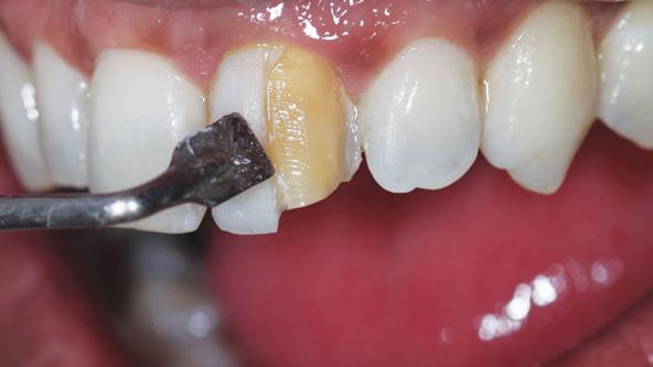 وارد کننده مواد کامپوزیت دندان آلمانی