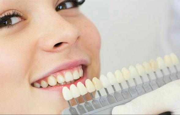 بهترین مواد کامپوزیتی دندان کدام اند؟